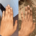 Before and after skin brightening on hands — knuckles visibly lighter