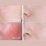 Before and after skin comparison showing reduced redness and smoother texture from brightening routine