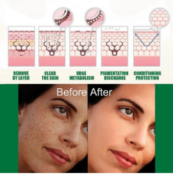 Eelhoe Dark Spot Correcting Glow Serum & Hoygi Niacinamide 10%+TXA 3% Serum